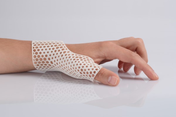 Nẹp tay được in 3D tương thích với cấu trúc bàn tay của từng bệnh nhân